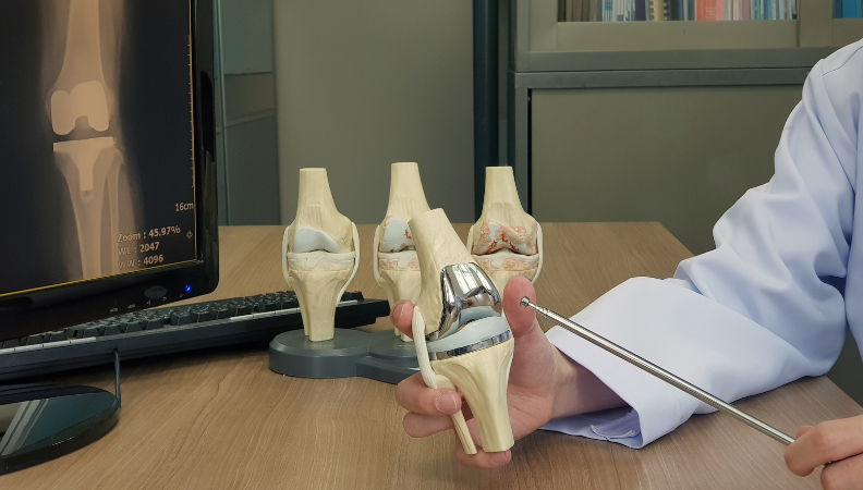 Partial Knee Replacement Surgery